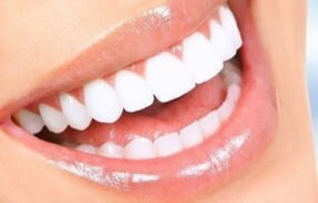 Produto-Clareamento Dental🦷✨